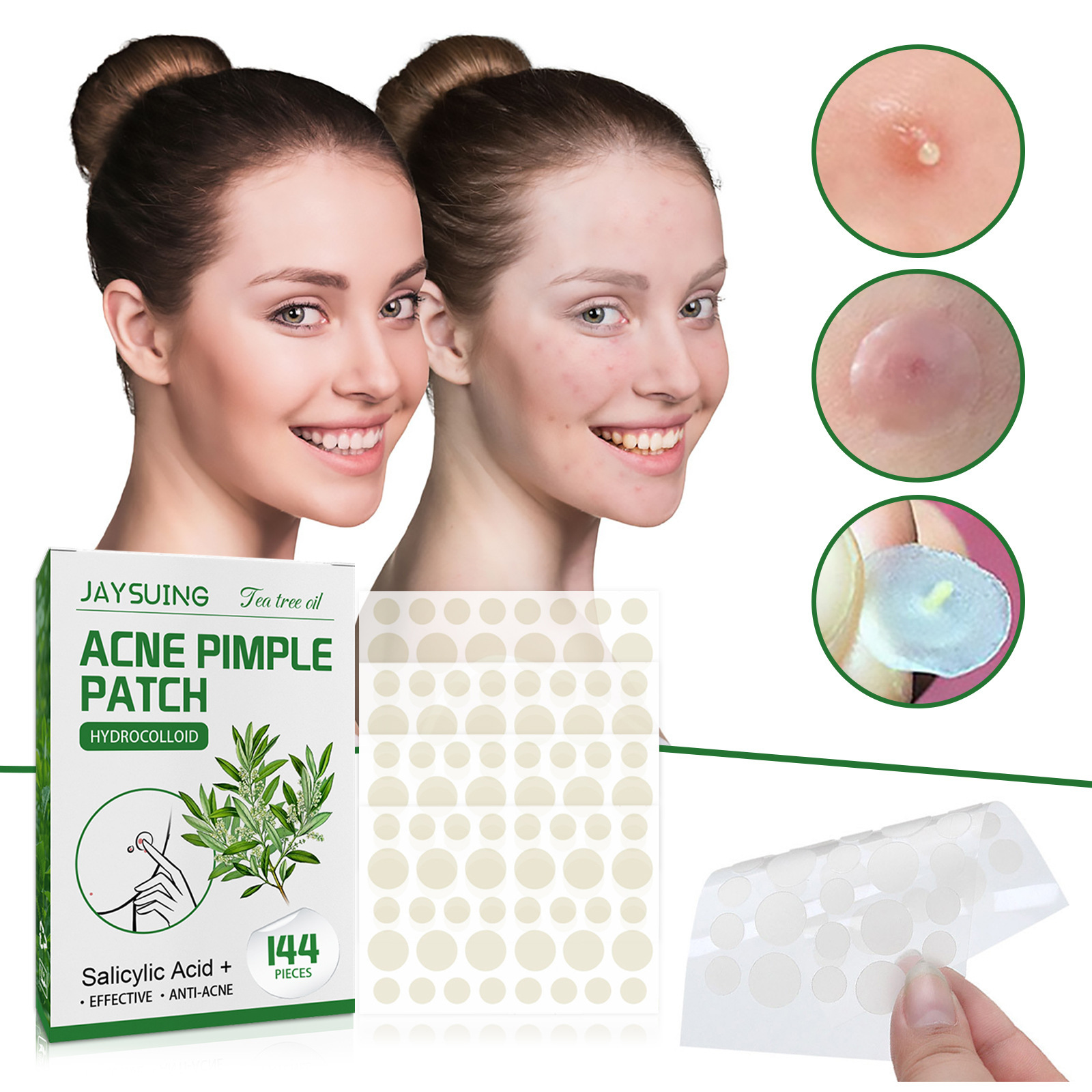 Hydrokolloid-Akne-Pflaster – a – Hydrocolloid Acne Patch Bewertung und Preis