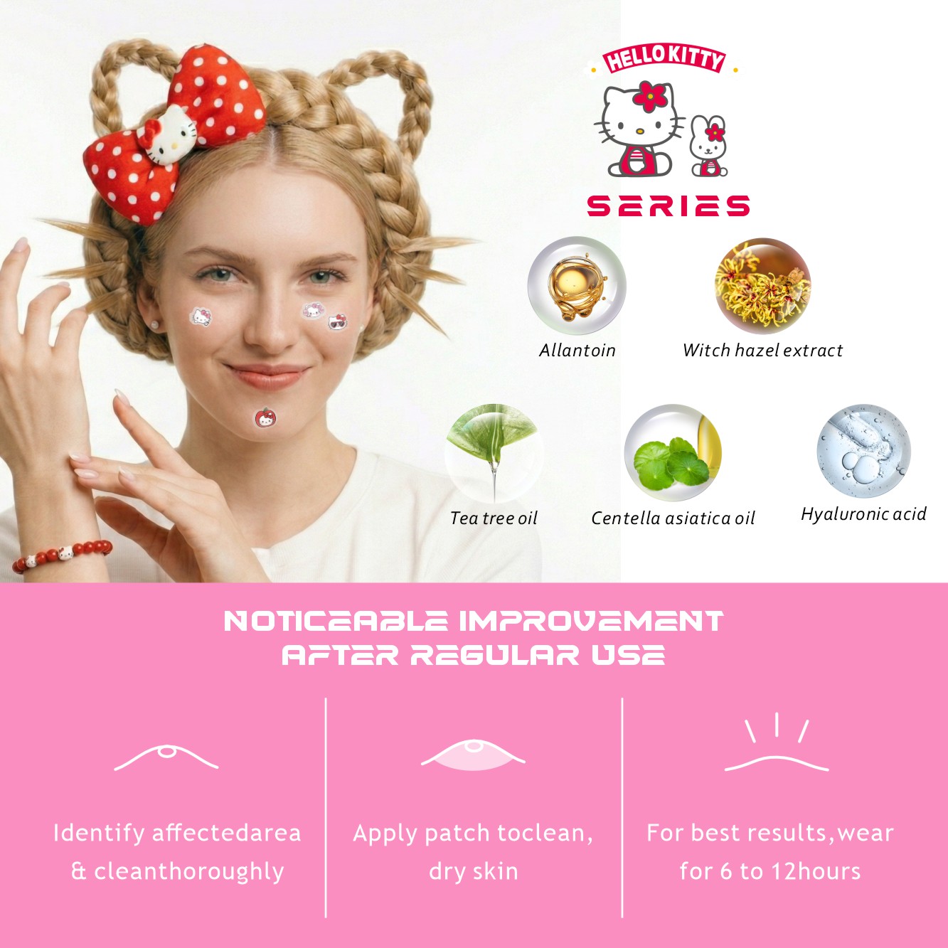 25/125 Stück Hello Kitty Picke – Hydrocolloid Acne Patch Bewertung und Preis
